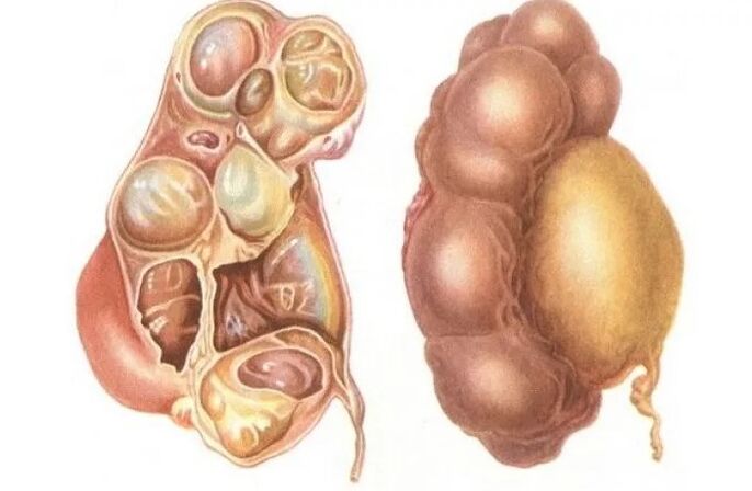 Bladder