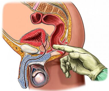 Digital prostate exam