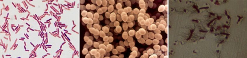 Escherichia coli, fecal enterococcus and Proteus are the main causative agents of chronic bacterial prostatitis