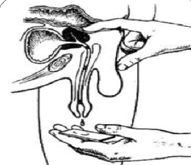 Massage the prostate gland to obtain secretions