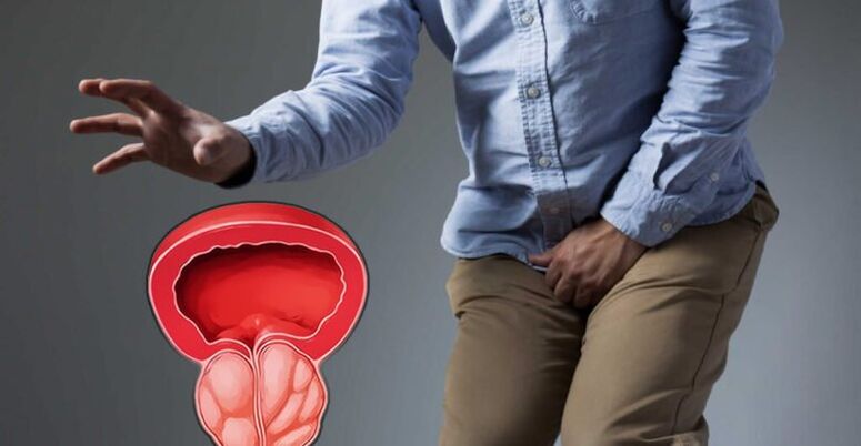 Prostatitis prevention and prostate adenoma